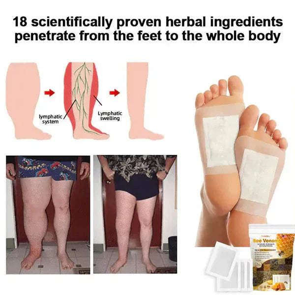Bee Venom™ Lymphatic Drainage & Slimming Foot Patches (Super Quality 2.0)