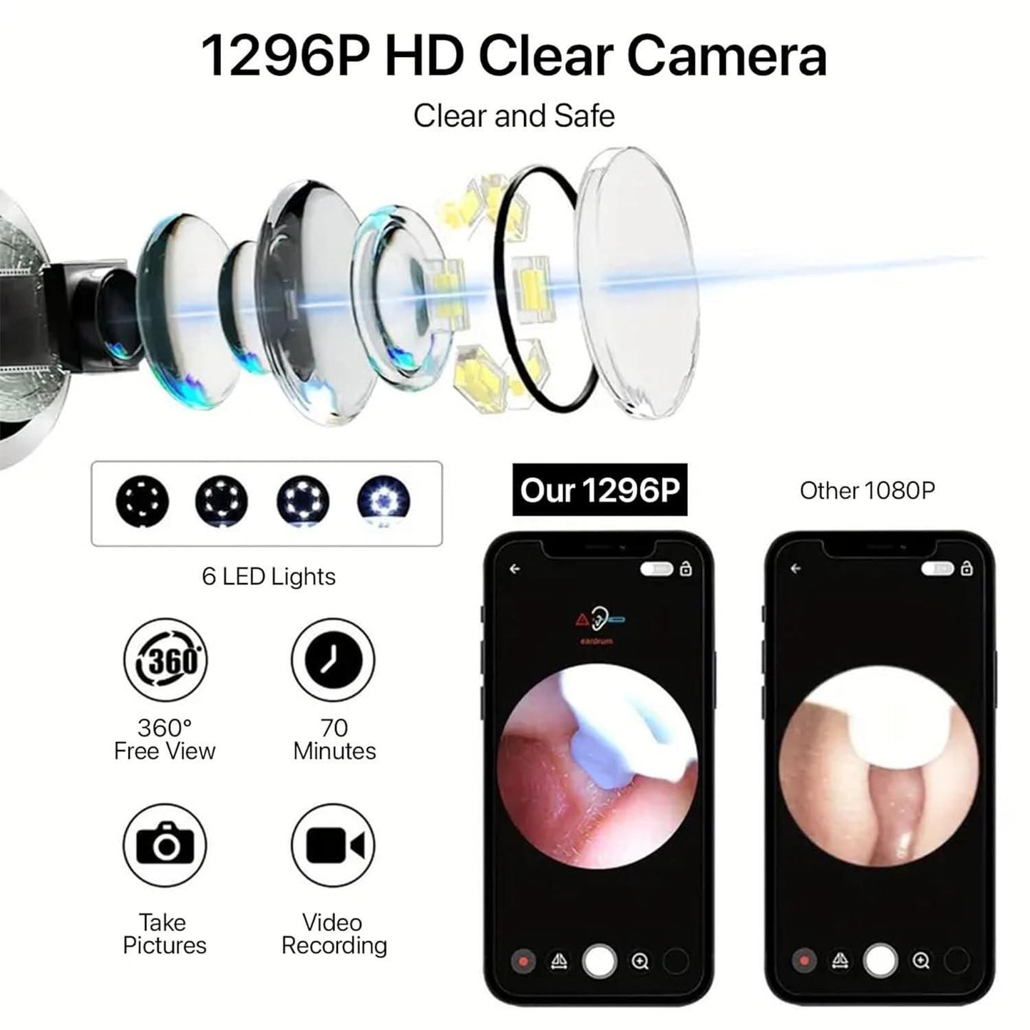 Smart Ear Waxx™ Cleaner With Camera HD | 1080P | 1Yr Warranty