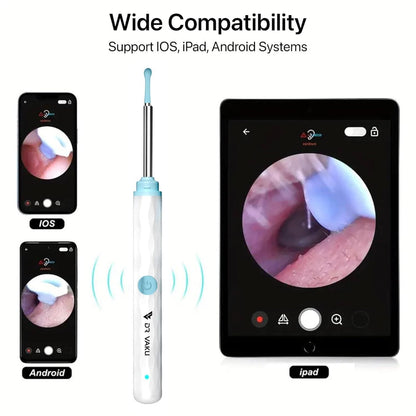 Smart Ear Waxx™ Cleaner With Camera HD | 1080P | 1Yr Warranty