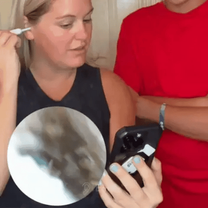 Smart Ear Waxx™ Cleaner With Camera HD | 1080P | 1Yr Warranty
